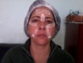 EU MESMO ME TRATO COM SCULTFACE - VEJA A FOTO COMO FICA NA HORA DO TRATAMENTO
